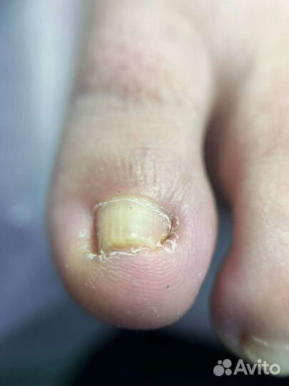 Педикюр,Подолог