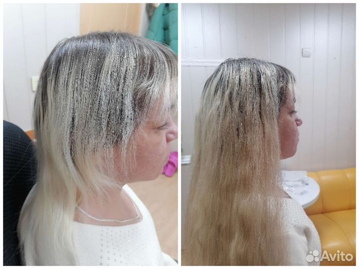 Загущение височной, затылочной области