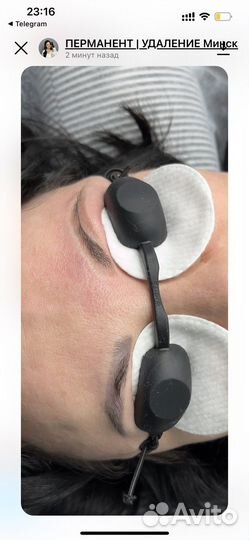 Модель на Удаление тату / Перманентного макияжа