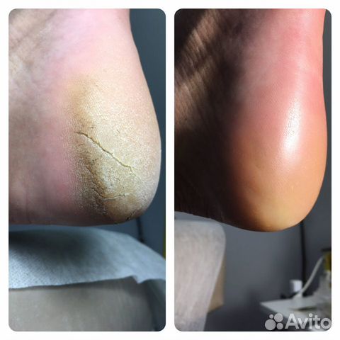 Smart педикюр ламинирование ресниц. звоните