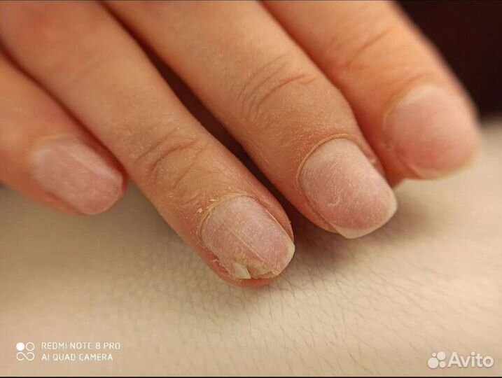 Повышение квалификации по маникюру