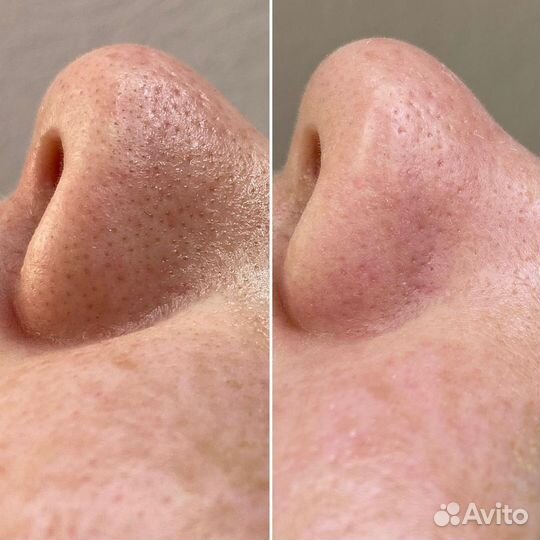 Косметолог с мед. образованием