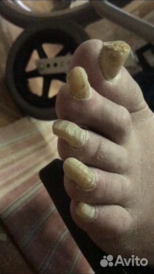 Медицинский Педикюр на дому для пожилых