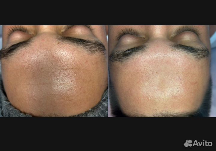 Косметолог с медицинским образованием