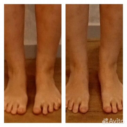 Антицеллюлитный массаж