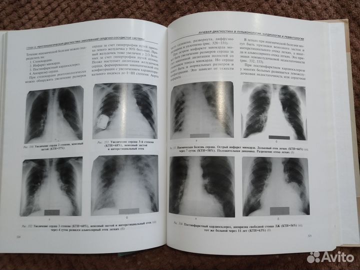 Книга медицинская (для рентгенологов)