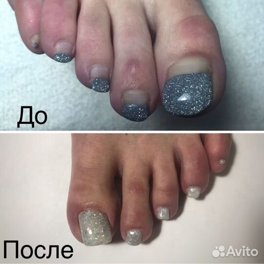 Наращивание ногтей,педикюр,маникюр