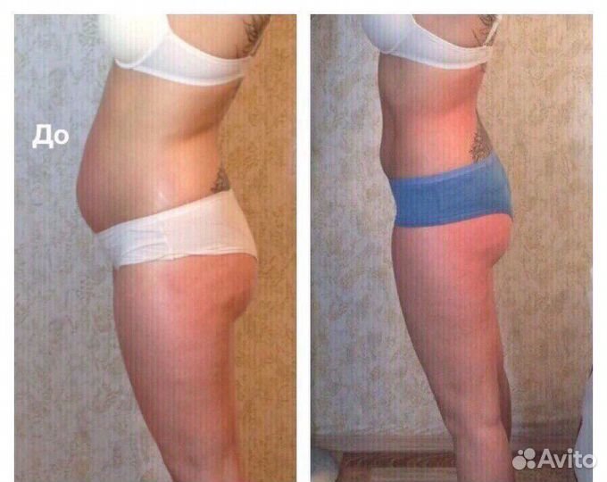 Массаж тела и лица / Ручная Липопластика