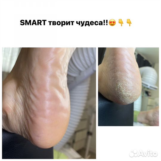 SMART педикюр, маникюр Абакан