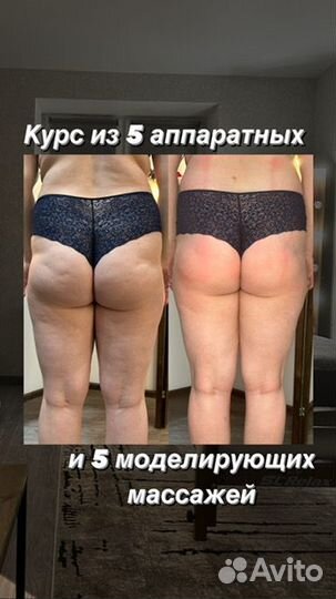 Массаж Кудрово Ручной, аппаратный, обертывания,SPA