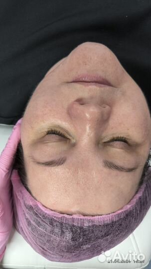 Услуги косметолога