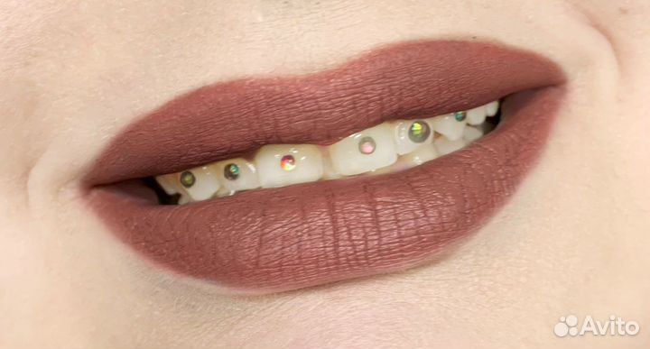 Скайсы на зубы/ установка страз Swarovski