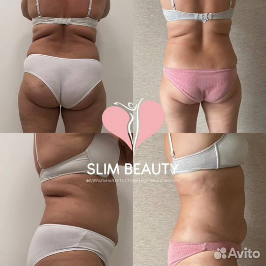 Похудение до 10 кг за курс