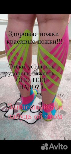 Тейпирование в Соликамске