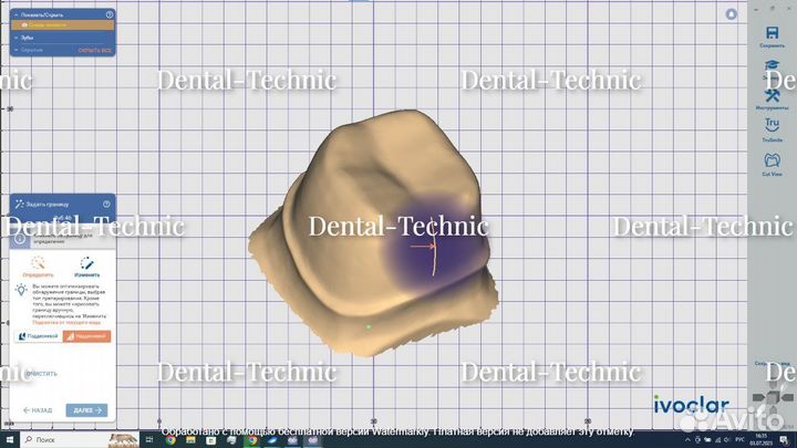 Exocad Rijeka Ivoclar v8458 (2023 )