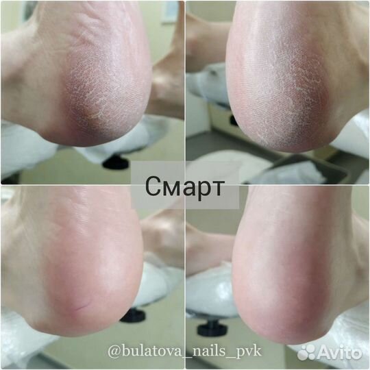 Маникюр, педикюр. Динас