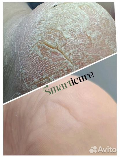 Мужской педикюр и маникюр