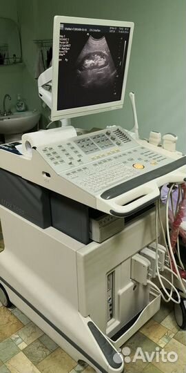 Сдаю в аренду узи аппарат, сканер ультразвуковой д