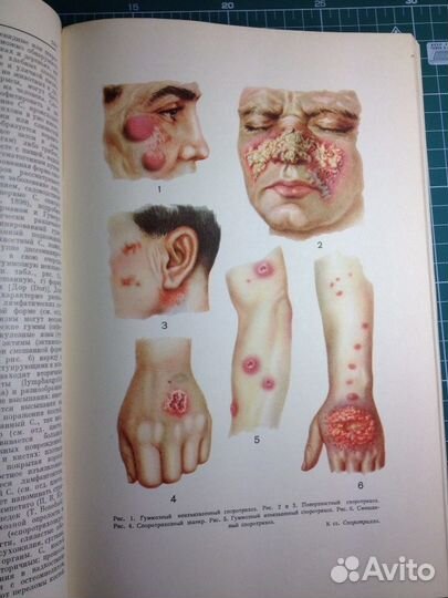 Большая медицинская энциклопедия том 31