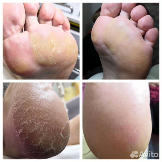 Маникюр+педикюр