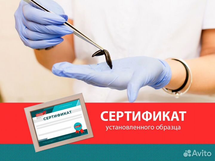 Курсы гирудотерапии, обучение гирудотерапии