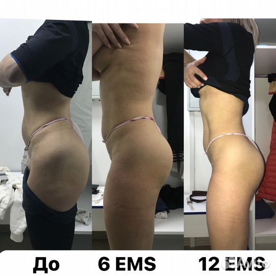 EMS тренировки