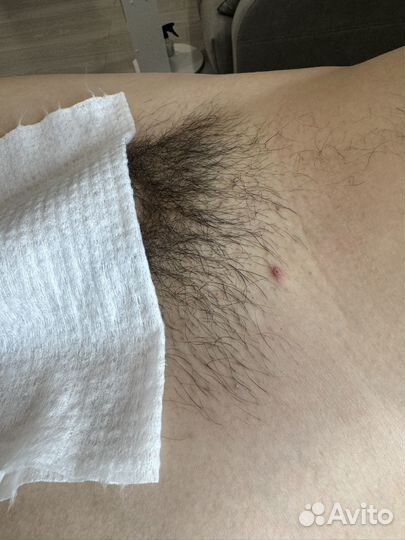 Мужская депиляция,шугаринг мужской