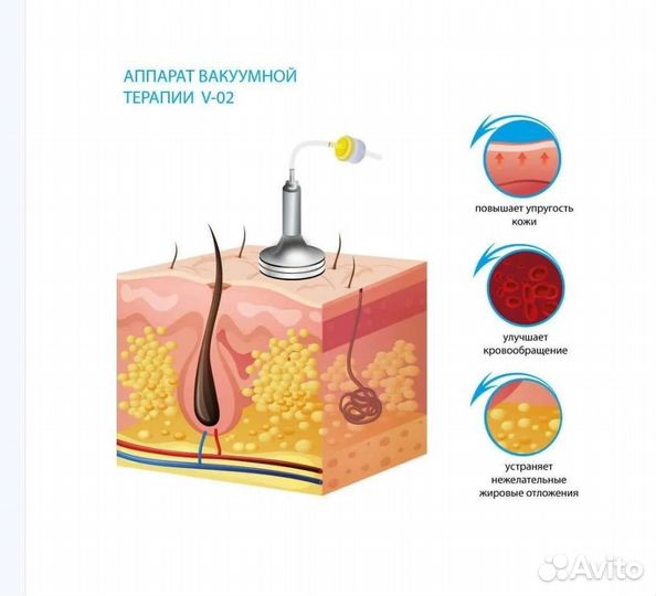 Вакуумно-роликовый массаж/выезд на дом