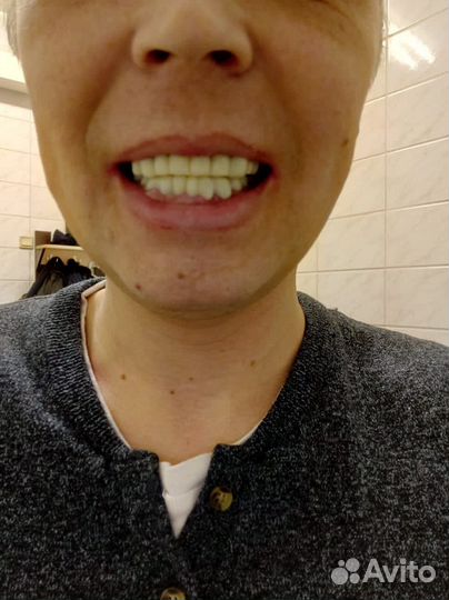 Починка зубного протеза