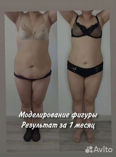 Аппаратная коррекция фигуры