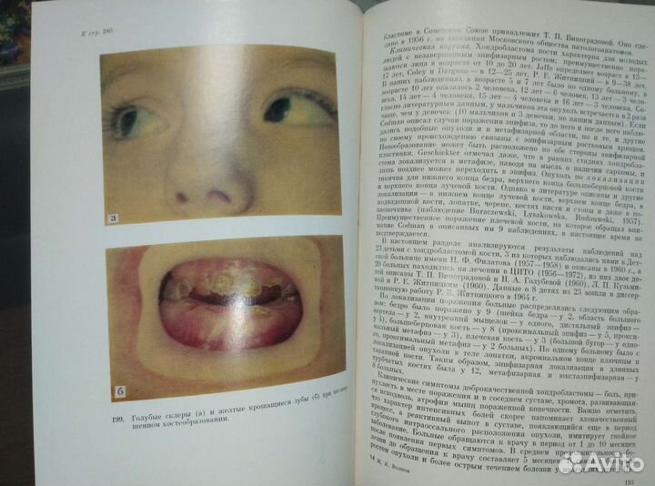 Болезни костей у детей. М.В.Волков.ссср 1974г