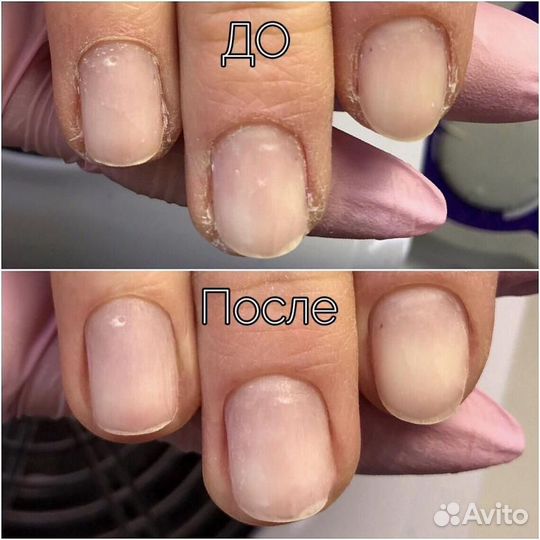 Наращивание и коррекция ногтей