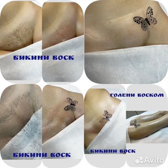 Шугаринг/воск