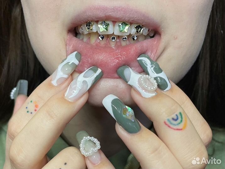 Установка скайсов (кристаллов/страз на зубы)