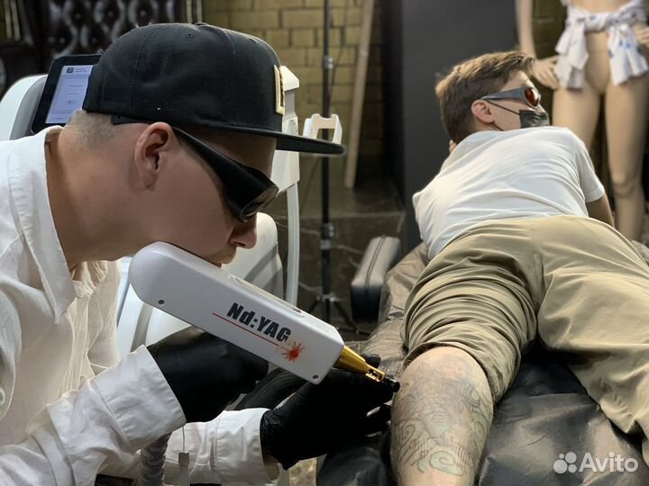 Лазерное удаление татуажа и татуировок