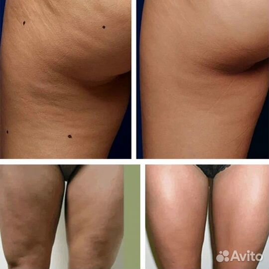 Ручной массаж