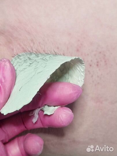 LPG,Коррекция фигуры, Кавитация, Депиляция жд окр