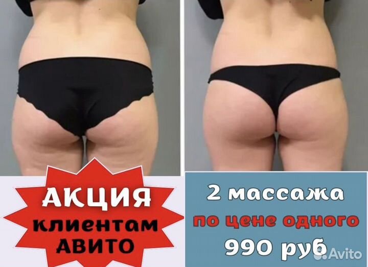Массаж LPG Антицеллюлитный массаж Похудение
