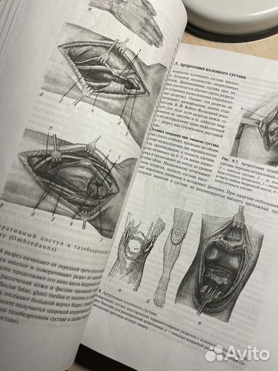 Топографическая анатомия
