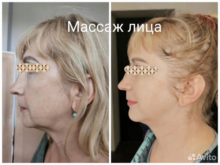 Массаж лица