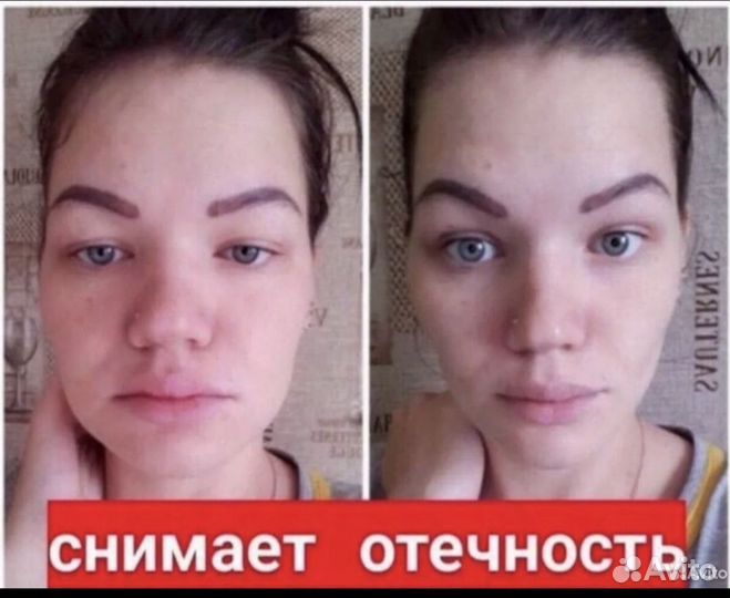 Драйнэффект