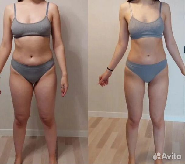 Кавитация коррекция фигуры