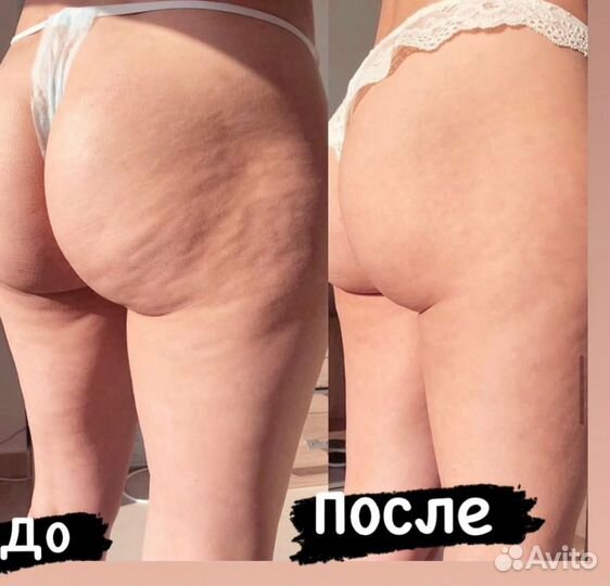 Аппаратный массаж.Похудеть за 16 дней