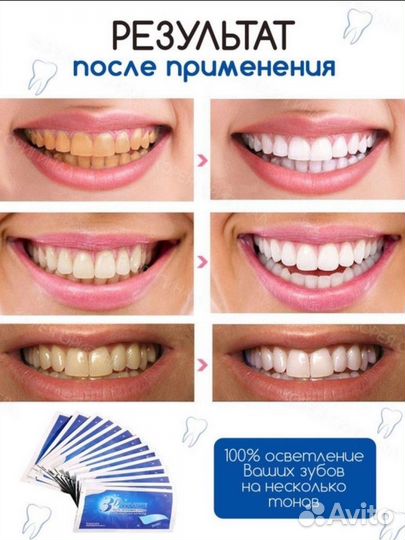 Отбеливание зубов