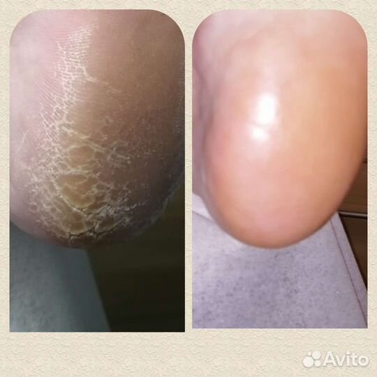 Педикюр, подология и эстетика