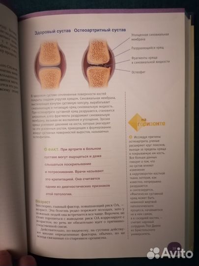 Что делать, если у вас артрит. Ридерз Дайджест