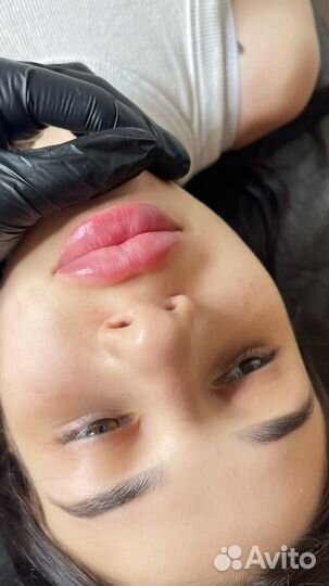 Увеличение губ