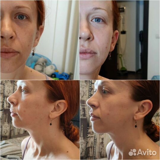 Массаж лица и тела