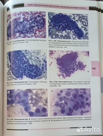 Цитологическая атлас. Щитовидной железы