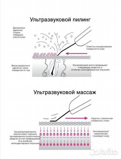 Аппарат для ультразвуковой чистки лица массажер